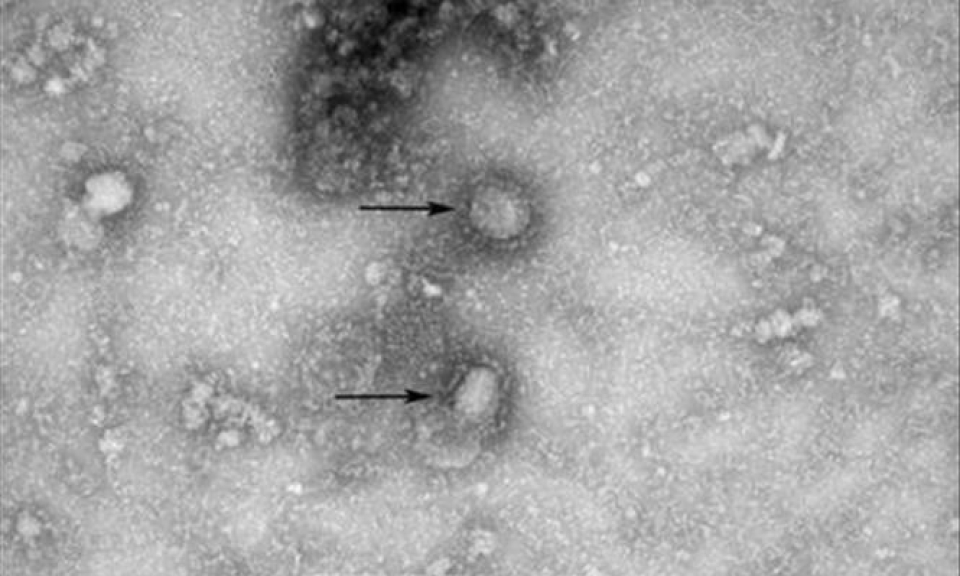 Th&aacute;i Lan ghi nhận trường hợp thứ hai nhiễm chủng virus corona mới