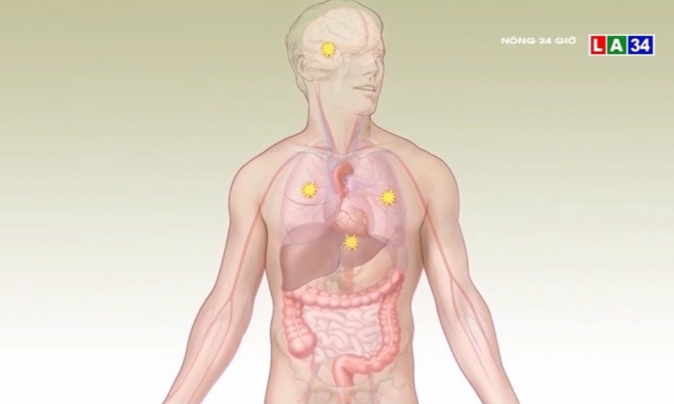 Cẩn trọng: Ung thư v&uacute; ở nam giới nguy hiểm hơn phụ nữ