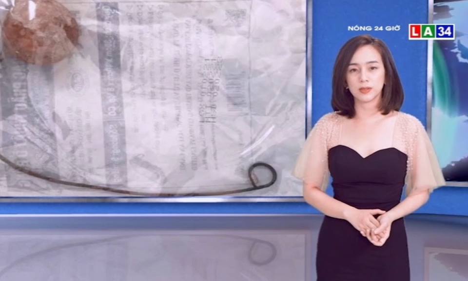 Cụ b&agrave; qu&ecirc;n ống dẫn nước tiểu 9 năm trong cơ thể, sỏi b&aacute;m to bằng quả trứng