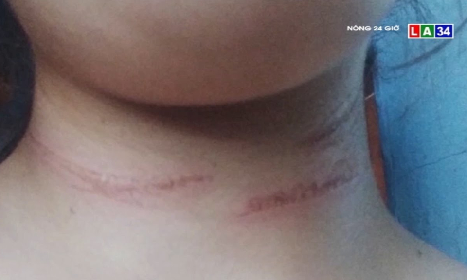 Thả diều – Th&uacute; chơi tiềm ẩn nhi&ecirc;u nguy cơ tai nạn