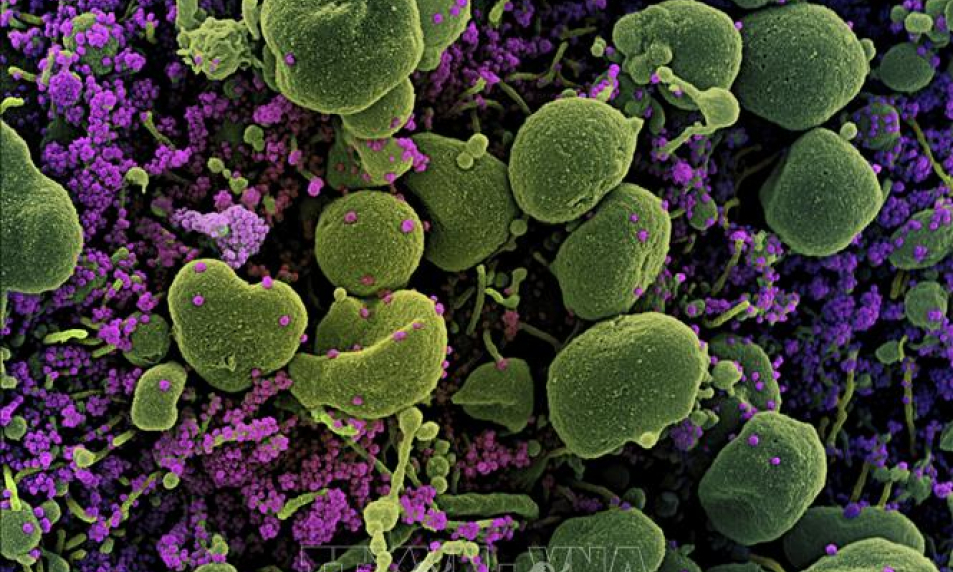 Giới khoa học Thụy Sĩ ph&aacute;t hiện điểm yếu quan trọng của virus SARS-CoV-2