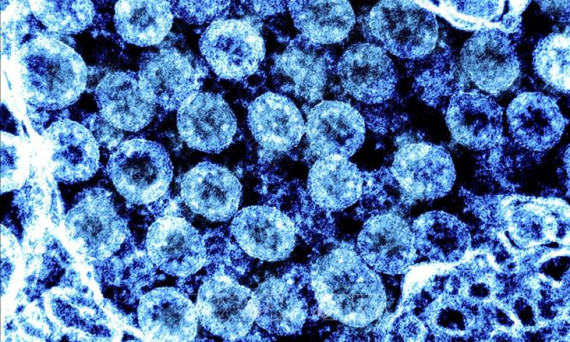 Người nhiễm biến thể Delta c&oacute; thể l&acirc;y lan virus 2 ng&agrave;y trước khi c&oacute; triệu chứng