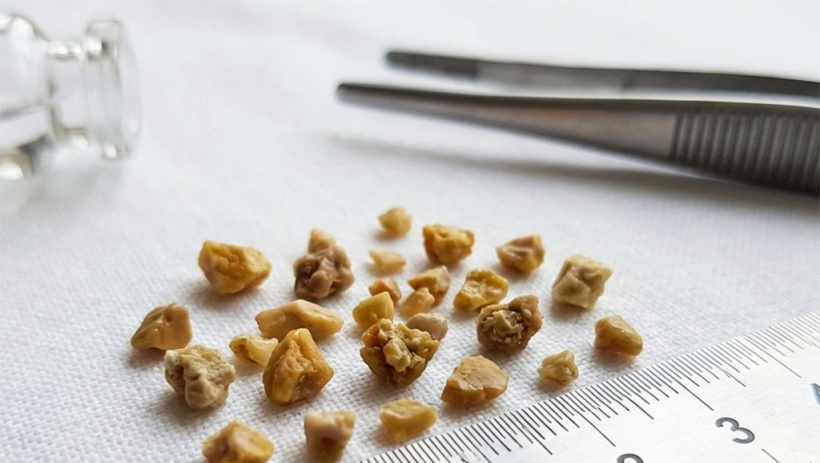 Kh&ocirc;ng bỏ th&oacute;i quen tưởng v&ocirc; hại n&agrave;y, suy thận hồi n&agrave;o kh&ocirc;ng hay