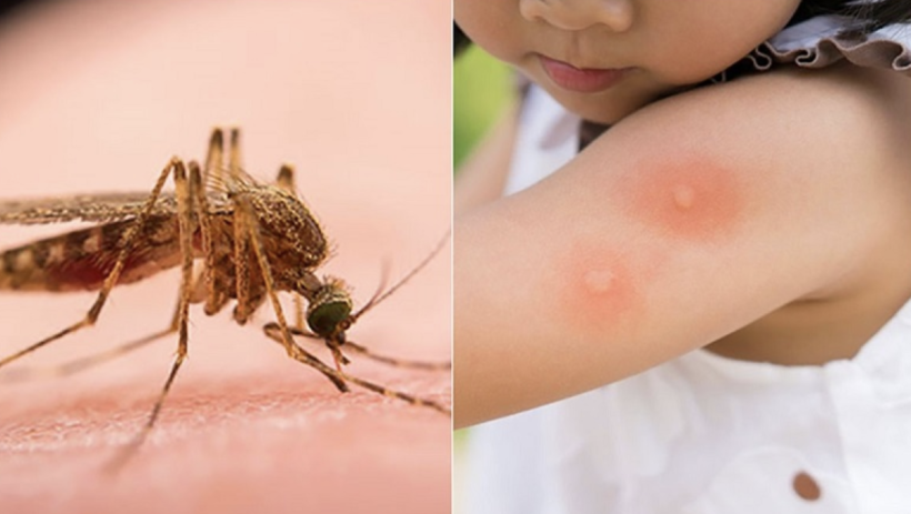 Du xu&acirc;n an to&agrave;n: Cẩn thận c&ocirc;n tr&ugrave;ng đốt, t&uacute;i y tế mang theo cần g&igrave;?