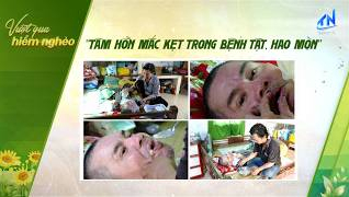 T&acirc;m hồn mắc kẹt trong bệnh tật, hao m&ograve;n