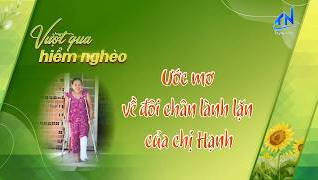 Ước mơ về một đ&ocirc;i ch&acirc;n l&agrave;nh lặn