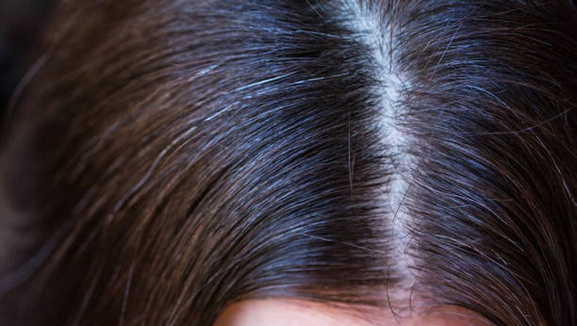 Vị tr&iacute; t&oacute;c bạc phản &aacute;nh t&igrave;nh trạng sức khỏe của bạn như thế n&agrave;o?